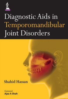 Diagnostic Aids in Temporomandibular Joint Disorders by Shahid Hassan - Paperback