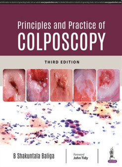 Principles and Practice of Colposcopy by B Shakuntala Baliga - Hardback
