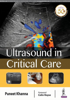 Ultrasound in Critical Care by Puneet Khanna - Paperback