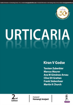 Urticaria by Kiran V Godse - Paperback