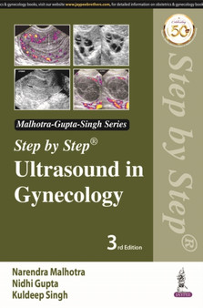 Step by Step Ultrasound in Gynecology by Narendra Malhotra - Paperback