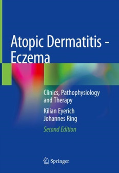 Atopic Dermatitis - Eczema : Clinics, Pathophysiology and Therapy by Kilian Eyerich - Hardback