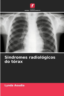 Sindromes radiologicos do torax by Lynda Aoudia - Paperback
