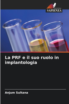 La PRF e il suo ruolo in implantologia by Anjum Sultana - Paperback