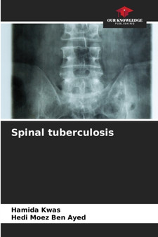 Spinal tuberculosis by Hamida Kwas - Paperback