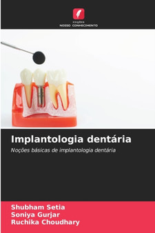 Implantologia dentaria by Shubham Setia - Paperback