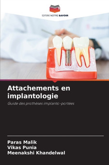 Attachements en implantologie by Paras Malik - Paperback