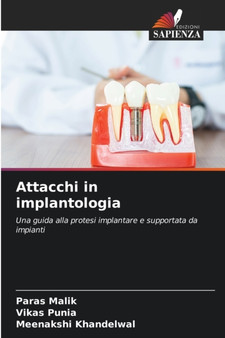 Attacchi in implantologia by Paras Malik - Paperback