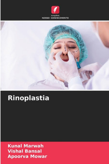 Rinoplastia by Kunal Marwah - Paperback