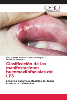 Clasificacion de las manifestaciones bucomaxilofaciales del LES by Otto Aleman Miranda - Paperback