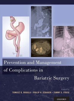 Prevention and Management of Complications in Bariatric Surgery by Tomasz G. Associate Professor of Surgery Bariatric and Metabolic Insti - Hardback