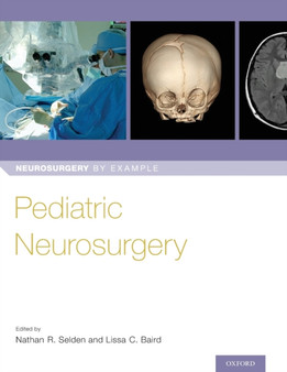 Pediatric Neurosurgery by Dr Nathan Selden - Paperback