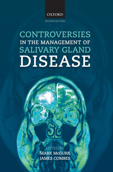 Controversies in the Management of Salivary Gland Disease by Mark McGurk - Hardback