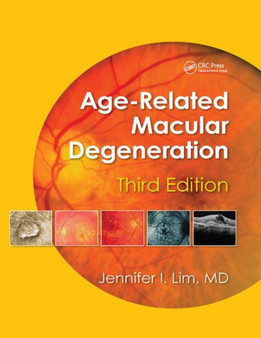 Age-Related Macular Degeneration, Third Edition by Jennifer I. Lim - Paperback