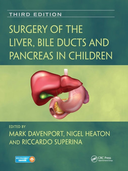 Surgery of the Liver, Bile Ducts and Pancreas in Children by Mark Davenport - Paperback