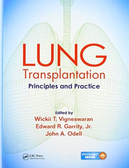 Lung Transplantation : Principles and Practice by Wickii Vigneswaran - Paperback