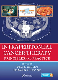 Intraperitoneal Cancer Therapy : Principles and Practice by Wim P. Ceelen - Paperback