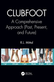 Clubfoot : A Comprehensive Approach (Past, Present, and Future) by R.L. Mittal - Hardback