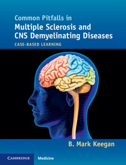 Common Pitfalls in Multiple Sclerosis and CNS Demyelinating Diseases : Case-Based Learning by B.Mark Keegan - Paperback