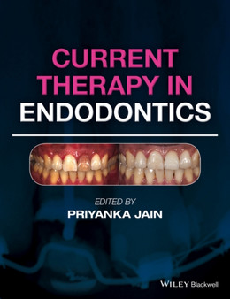 Current Therapy in Endodontics by Priyanka Jain - Hardback