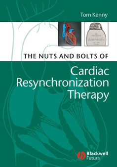 The Nuts and Bolts of Cardiac Resynchronization Therapy by Tom Kenny - Paperback