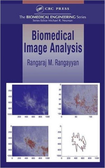 Biomedical Image Analysis by Rangaraj M. Rangayyan - Hardback