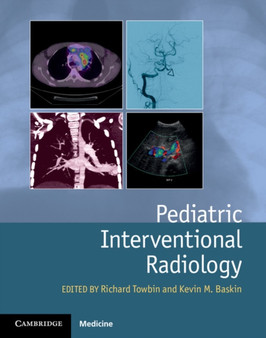 Pediatric Interventional Radiology by Richard Towbin - Hardback