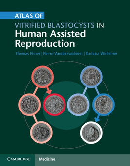 Atlas of Vitrified Blastocysts in Human Assisted Reproduction by Thomas Ebner - Hardback Atlas of Vitrified Blastocysts in Human Assisted Reproduction by Thomas Ebner - Hardback