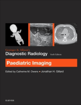 Grainger & Allison's Diagnostic Radiology: Paediatric Imaging by Catherine Owens - Paperback Grainger & Allison's Diagnostic Radiology: Paediatric Imaging by Catherine Owens - Paperback