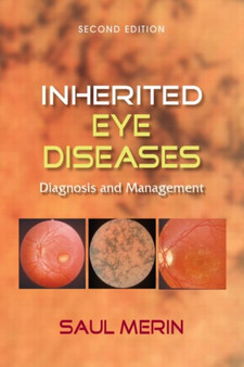 Inherited Eye Diseases : Diagnosis and Management by Saul Merin - Hardback