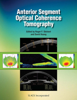 Anterior Segment Optical Coherence Tomography by Roger F. Steinert - Hardback