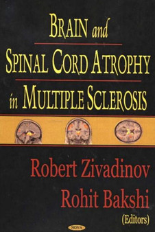 Brain & Spinal Cord Atrophy in Multiple Sclerosis by Robert Zivadinov - Hardback