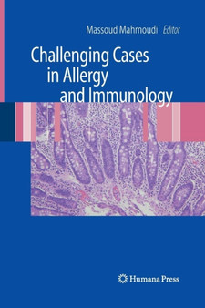 Challenging Cases in Allergy and Immunology by Massoud Mahmoudi - Paperback