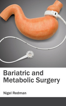 Bariatric and Metabolic Surgery by Nigel Redman - Hardback