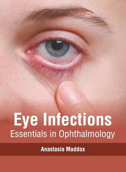 Eye Infections: Essentials in Ophthalmology by Anastasia Maddox - Hardback