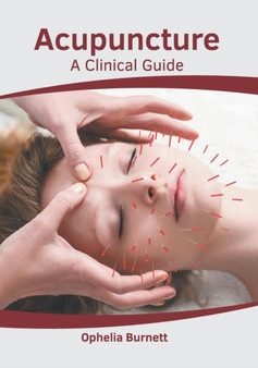 Acupuncture: A Clinical Guide by Ophelia Burnett - Hardback