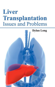 Liver Transplantation: Issues and Problems by Dylan Long - Hardback