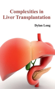Complexities in Liver Transplantation by Dylan Long - Hardback