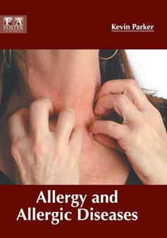 Allergy and Allergic Diseases by Kevin Parker - Hardback