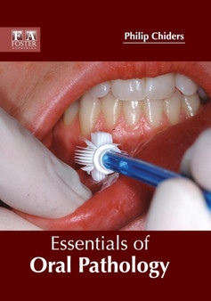 Essentials of Oral Pathology by Philip Chiders - Hardback