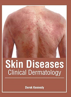 Skin Diseases: Clinical Dermatology by Derek Kennedy - Hardback