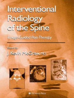 Interventional Radiology of the Spine : Image-Guided Pain Therapy by J.Kevin McGraw - Paperback