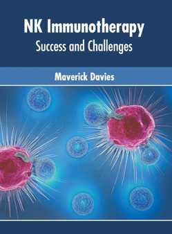 NK Immunotherapy: Success and Challenges by Maverick Davies - Hardback