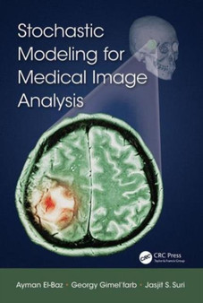 Stochastic Modeling for Medical Image Analysis by Ayman El-Baz - Hardback