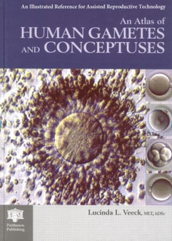 An Atlas of Human Gametes and Conceptuses : An Illustrated Reference for Assisted Reproductive Technology by Lucinda L. Veeck - Hardback
