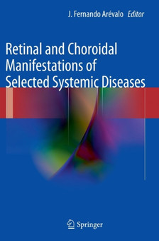 Retinal and Choroidal Manifestations of Selected Systemic Diseases by J.Fernando Arevalo - Hardback