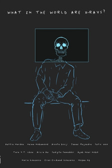 What in the World are X-Rays? by Austin Mardon - Paperback