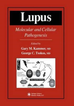 Lupus : Molecular and Cellular Pathogenesis by Kammer Gary M. Kammer - Paperback
