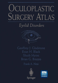 Oculoplastic Surgery Atlas : Eyelid Disorders by T.C. Hengst - Paperback