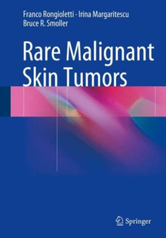 Rare Malignant Skin Tumors by Franco Rongioletti - Hardback